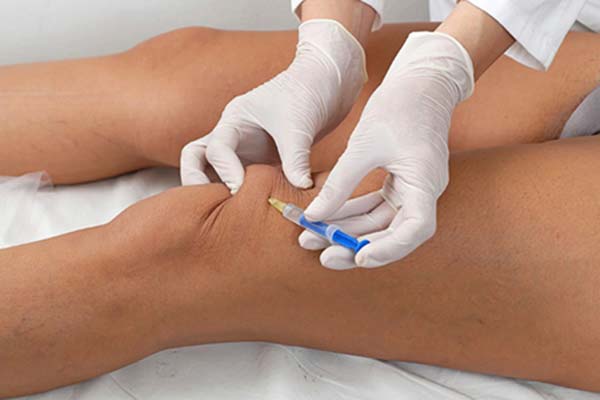 اوزون یا ازن (ozone) چیست؟